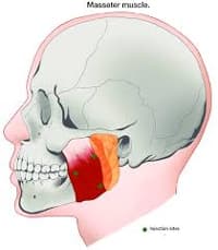 TMJ Botox Masseter